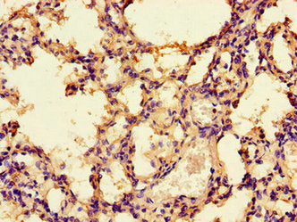 Immunohistochemistry of paraffin-embedded human lung tissue using PRKAA1 Antibody at dilution of 1:100Rabbit anti-Human PRKAA1 Polyclonal Antibody