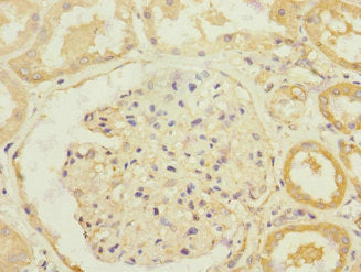 Immunohistochemistry of paraffin-embedded human kidney tissue using SLC13A2 Antibody at dilution of 1:100Rabbit anti-Human SLC13A2 Polyclonal Antibody