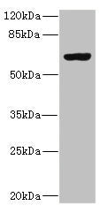Western blot  | All lanes: SLC13A2 antibody at 1.29µg/ml + 293T whole cell lysate  | Secondary  | Goat polyclonal to rabbit IgG at 1/10000 dilution  | Predicted band size: 65, 70 kDa  | Observed band size: 65 kDaRabbit anti-Human SLC13A2 Polyclonal Antibody