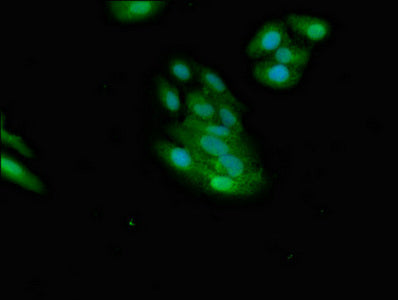 Immunofluorescent analysis of HepG2 cells using NMI Antibody at dilution of 1:100 and Alexa Fluor 488-congugated AffiniPure Goat Anti-Rabbit IgG(H+L)Rabbit anti-Human NMI Polyclonal Antibody