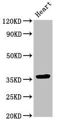 Western Blot | Positive WB detected in: Rat heart tissue | All lanes: NMI antibody at 3.5μg/ml | Secondary | Goat polyclonal to rabbit IgG at 1/50000 dilution | Predicted band size: 36 kDa | Observed band size: 36 kDaRabbit anti-Human NMI Polyclonal Antibody