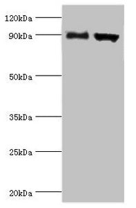 Western blot | All lanes: Disintegrin and metalloproteinase domain-containing protein 9 antibody at 2μg/ml | Lane 1: Mouse liver tissue | Lane 2: Mouse heart tissue | Secondary | Goat polyclonal to rabbit IgG at 1/10000 dilution | Predicted band size: 91, 73 kDa | Observed band size: 91 kDa