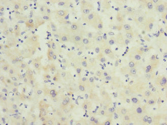Immunohistochemistry of paraffin-embedded human liver tissue using FHL3 Antibody at dilution of 1:100Rabbit anti-Human FHL3 Polyclonal Antibody