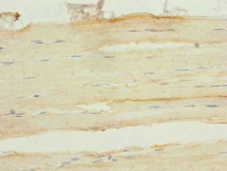 Immunohistochemistry of paraffin-embedded human skeletal muscle tissue using FHL3 Antibody at dilution of 1:100Rabbit anti-Human FHL3 Polyclonal Antibody