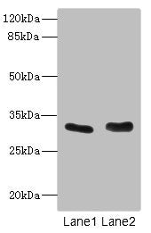 Western blot | All lanes: FHL3 antibody at 1.42μg/ml | Lane 1: Human placenta tissue | Lane 2: K562 whole cell lysate | Secondary | Goat polyclonal to rabbit IgG at 1/10000 dilution | Predicted band size: 31 kDa | Observed band size: 31 kDaRabbit anti-Human FHL3 Polyclonal Antibody