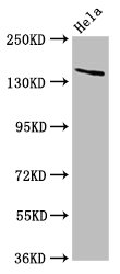 Western Blot | Positive WB detected in: Hela whole cell lysate | All lanes: LAMC2 antibody at 5μg/ml | Secondary | Goat polyclonal to rabbit IgG at 1/50000 dilution | Predicted band size: 131, 122 kDa | Observed band size: 140 kDa