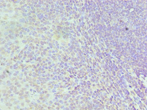 Immunohistochemistry of paraffin-embedded human tonsil tissue using HNRNPD Antibody at dilution of 1:100Rabbit anti-Human HNRNPD Polyclonal Antibody
