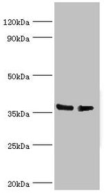 Western blot  | All lanes: HNRNPD antibody at 4µg/ml  | Lane 1: Hela whole cell lysate  | Lane 2: 293T whole cell lysate  | Secondary  | Goat polyclonal to rabbit IgG at 1/10000 dilution  | Predicted band size: 39, 37, 33, 31 kDa  | Observed band size: 39 kDaRabbit anti-Human HNRNPD Polyclonal Antibody