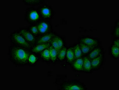 Immunofluorescent analysis of A549 cells using RCAN2 Antibody at dilution of 1:100 and Alexa Fluor 488-congugated AffiniPure Goat Anti-Rabbit IgG(H+L)Rabbit anti-Human RCAN2 Polyclonal Antibody