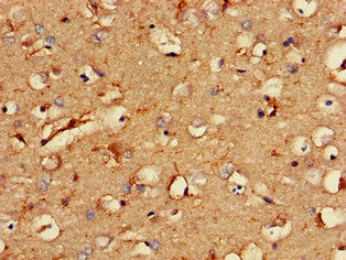 Immunohistochemistry of paraffin-embedded human brain tissue using RCAN2 Antibody at dilution of 1:100Rabbit anti-Human RCAN2 Polyclonal Antibody