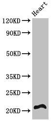 Western Blot | Positive WB detected in: Mouse heart tissue | All lanes: RCAN2 antibody at 3μg/ml | Secondary | Goat polyclonal to rabbit IgG at 1/50000 dilution | Predicted band size: 22, 28 kDa | Observed band size: 22 kDaRabbit anti-Human RCAN2 Polyclonal Antibody