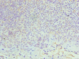 Immunohistochemistry of paraffin-embedded human tonsil tissue using MCM6 Antibody at dilution of 1:100