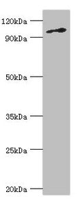 Western blot | All lanes: DNA replication licensing factor MCM6 antibody at 3μg/ml + Jurkat whole cell lysate | Secondary | Goat polyclonal to rabbit IgG at 1/10000 dilution | Predicted band size: 93 kDa | Observed band size: 93 kDa