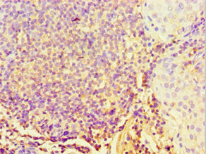 Immunohistochemistry of paraffin-embedded human tonsil tissue using STARD3 Antibody at dilution of 1:100Rabbit anti-Human STARD3 Polyclonal Antibody