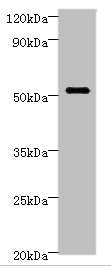 Western blot | All lanes: STARD3 Antibody at 6μg/ml + MCF-7 whole cell lysate | Secondary | Goat polyclonal to rabbit IgG at 1/10000 dilution | Predicted band size: 51, 49, 50 kDa | Observed band size: 51 kDaRabbit anti-Human STARD3 Polyclonal Antibody