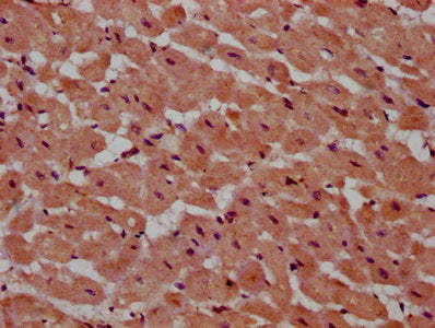 IHC image of PSME4 Antibody diluted at 1:600 and staining in paraffin-embedded human heart tissue performed on a Leica BondTM system. After dewaxing and hydration, antigen retrieval was mediated by high pressure in a citrate buffer (pH 6.0). Section was blocked with 10% normal goat serum 30min at RT. Then primary antibody (1% BSA) was incubated at 4°C overnight. The primary is detected by a biotinylated secondary antibody and visualized using an HRP conjugated SP system.Rabbit anti-Human PSME4 Polyclonal Antibody