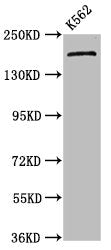 Western Blot | Positive WB detected in: K562 whole cell lysate | All lanes: PSME4 antibody at 4.5μg/ml | Secondary | Goat polyclonal to rabbit IgG at 1/50000 dilution | Predicted band size: 212, 140, 114, 25 kDa | Observed band size: 212 kDaRabbit anti-Human PSME4 Polyclonal Antibody