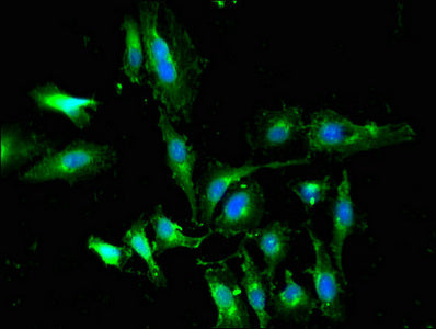 Immunofluorescent analysis of Hela cells using WTAP Antibody at dilution of 1:100 and Alexa Fluor 488-congugated AffiniPure Goat Anti-Rabbit IgG(H+L)Rabbit anti-Human WTAP Polyclonal Antibody
