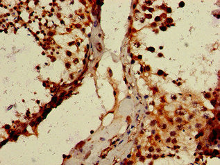 Immunohistochemistry of paraffin-embedded human testis tissue using WTAP Antibody at dilution of 1:100Rabbit anti-Human WTAP Polyclonal Antibody