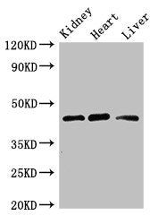 Western Blot | Positive WB detected in: Mouse kidney tissue, Rat heart tissue, Rat liver tissue | All lanes: WTAP antibody at 3μg/ml | Secondary | Goat polyclonal to rabbit IgG at 1/50000 dilution | Predicted band size: 45, 18 kDa | Observed band size: 45 kDaRabbit anti-Human WTAP Polyclonal Antibody
