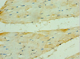 Immunohistochemistry of paraffin-embedded human skeletal muscle tissue using PDK2 Antibody at dilution of 1:100Rabbit anti-Human PDK2 Polyclonal Antibody