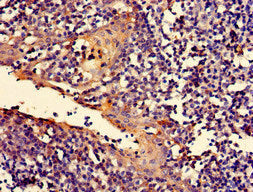 Immunohistochemistry of paraffin-embedded human tonsil tissue using RALBP1 Antibody at dilution of 1:100Rabbit anti-Human RALBP1 Polyclonal Antibody
