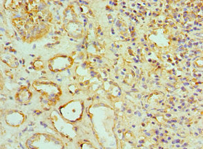 Immunohistochemistry of paraffin-embedded human kidney tissue using TOMM20 Antibody at dilution of 1:100Rabbit anti-Human TOMM20 Polyclonal Antibody