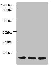 Western blot | All lanes: Mitochondrial import receptor subunit TOM20 homolog antibody at 3μg/ml | Lane 1: Mouse brain tissue | Lane 2: Hela whole cell lysate | Lane 3: Mouse liver tissue | Secondary | Goat polyclonal to rabbit IgG at 1/10000 dilution | Predicted band size: 16 kDa | Observed band size: 16 kDaRabbit anti-Human TOMM20 Polyclonal Antibody