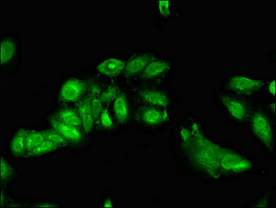 Immunofluorescent analysis of Hela cells using TRIP4 Antibody at dilution of 1:100 and Alexa Fluor 488-congugated AffiniPure Goat Anti-Rabbit IgG(H+L)Rabbit anti-Human TRIP4 Polyclonal Antibody