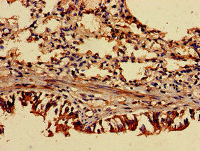Immunohistochemistry of paraffin-embedded human lung tissue using TRIP4 Antibody at dilution of 1:100Rabbit anti-Human TRIP4 Polyclonal Antibody