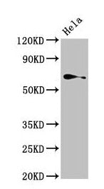 Western Blot  | Positive WB detected in: Hela whole cell lysate  | All lanes: TRIP4 antibody at 4µg/ml  | Secondary  | Goat polyclonal to rabbit IgG at 1/50000 dilution  | Predicted band size: 67 kDa  | Observed band size: 67 kDaRabbit anti-Human TRIP4 Polyclonal Antibody