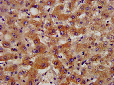 IHC image of NSDHL Antibody diluted at 1:400 and staining in paraffin-embedded human liver tissue performed on a Leica BondTM system. After dewaxing and hydration, antigen retrieval was mediated by high pressure in a citrate buffer (pH 6.0). Section was blocked with 10% normal goat serum 30min at RT. Then primary antibody (1% BSA) was incubated at 4°C overnight. The primary is detected by a biotinylated secondary antibody and visualized using an HRP conjugated SP system.Rabbit anti-Human NSDHL Polyclonal Antibody
