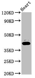 Western Blot | Positive WB detected in: Rat heart tissue | All lanes: NSDHL antibody at 7.2μg/ml | Secondary | Goat polyclonal to rabbit IgG at 1/50000 dilution | Predicted band size: 42 kDa | Observed band size: 42 kDaRabbit anti-Human NSDHL Polyclonal Antibody