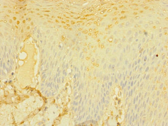 Immunohistochemistry of paraffin-embedded human tonsil tissue using CD226 Antibody at dilution of 1:100Rabbit anti-Human CD226 Polyclonal Antibody