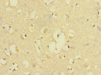 Immunohistochemistry of paraffin-embedded human brain tissue using CD226 Antibody at dilution of 1:100Rabbit anti-Human CD226 Polyclonal Antibody
