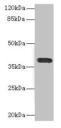 Western blot  | All lanes: CD226 antibody at 2.61µg/ml + A549 whole cell lysate  | Secondary  | Goat polyclonal to rabbit IgG at 1/10000 dilution  | Predicted band size: 39 kDa  | Observed band size: 39 kDaRabbit anti-Human CD226 Polyclonal Antibody