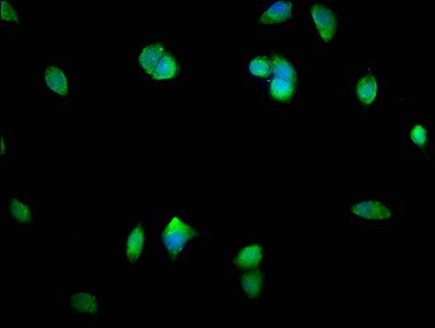 Immunofluorescence staining of MCF-7 cells with SMAD1 Antibody at 1:400, counter-stained with DAPI. The cells were fixed in 4% formaldehyde, permeabilized using 0.2% Triton X-100 and blocked in 10% normal Goat Serum. The cells were then incubated with the antibody overnight at 4°C. The secondary antibody was Alexa Fluor 488-congugated AffiniPure Goat Anti-Rabbit IgG(H+L).Rabbit anti-Human SMAD1 Polyclonal Antibody