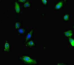 Immunofluorescent analysis of Hela cells using SMAD1 Antibody at dilution of 1:100 and Alexa Fluor 488-congugated AffiniPure Goat Anti-Rabbit IgG(H+L)Rabbit anti-Human SMAD1 Polyclonal Antibody