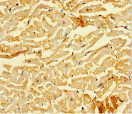 Immunohistochemistry of paraffin-embedded human heart tissue using the antibody at dilution of 1:100Rabbit anti-Human SMAD1 Polyclonal Antibody