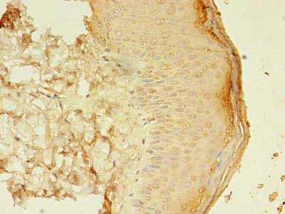 Immunohistochemistry of paraffin-embedded human skin tissue using the antibody at dilution of 1:100Rabbit anti-Human SMAD1 Polyclonal Antibody