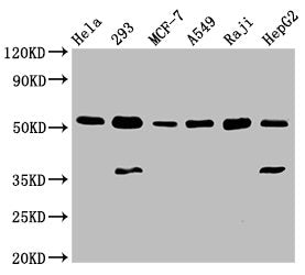 Western Blot  | Positive WB detected in: Hela whole cell lysate, 293 whole cell lysate, MCF-7 whole cell lysate, A549 whole cell lysate, Raji whole cell lysate, HepG2 whole cell lysate  | All lanes: SMAD1 antibody at 3µg/ml  | Secondary  | Goat polyclonal to rabbit IgG at 1/50000 dilution  | Predicted band size: 53, 16 kDa  | Observed band size: 53 kDaRabbit anti-Human SMAD1 Polyclonal Antibody