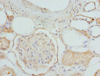 Immunohistochemistry of paraffin-embedded human kidney tissue using ETFDH Antibody at dilution of 1:100Rabbit anti-Human ETFDH Polyclonal Antibody