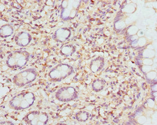 Immunohistochemistry of paraffin-embedded human small intestine tissue using ETFDH Antibody at dilution of 1:100Rabbit anti-Human ETFDH Polyclonal Antibody