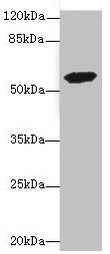 Western blot  | All lanes: ETFDH antibody at 3.56µg/ml + 293T whole cell lysate  | Secondary  | Goat polyclonal to rabbit IgG at 1/10000 dilution  | Predicted band size: 69, 63 kDa  | Observed band size: 63 kDaRabbit anti-Human ETFDH Polyclonal Antibody