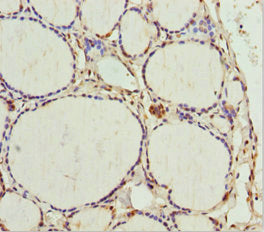 Immunohistochemistry of paraffin-embedded human thyroid tissue using TAF9 Antibody at dilution of 1:100