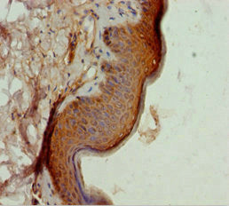 Immunohistochemistry of paraffin-embedded human skin tissue using TAF9 Antibody at dilution of 1:100