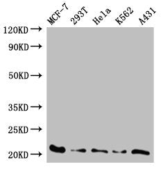 Western Blot | Positive WB detected in: MCF-7 whole cell lysate, 293T whole cell lysate, Hela whole cell lysate, K562 whole cell lysate, A431 whole cell lysate | All lanes: AK6 antibody at 0.59μg/ml | Secondary | Goat polyclonal to rabbit IgG at 1/50000 dilution | Predicted band size: 21, 20 kDa | Observed band size: 21 kDa