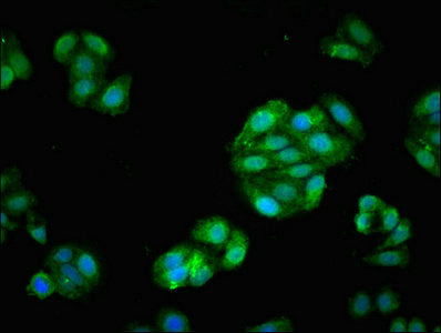 Immunofluorescent analysis of HepG2 cells using FSCN1 Antibody at dilution of 1:100 and Alexa Fluor 488-congugated AffiniPure Goat Anti-Rabbit IgG(H+L)Rabbit anti-Human FSCN1 Polyclonal Antibody