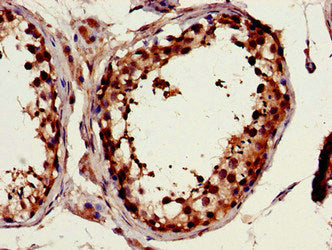 Immunohistochemistry of paraffin-embedded human testis tissue using FSCN1 Antibody at dilution of 1:100Rabbit anti-Human FSCN1 Polyclonal Antibody