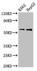 Western Blot | Positive WB detected in: K562 whole cell lysate, HepG2 whole cell lysate | All lanes: FSCN1 antibody at 3.2μg/ml | Secondary | Goat polyclonal to rabbit IgG at 1/50000 dilution | Predicted band size: 55 kDa | Observed band size: 55 kDaRabbit anti-Human FSCN1 Polyclonal Antibody